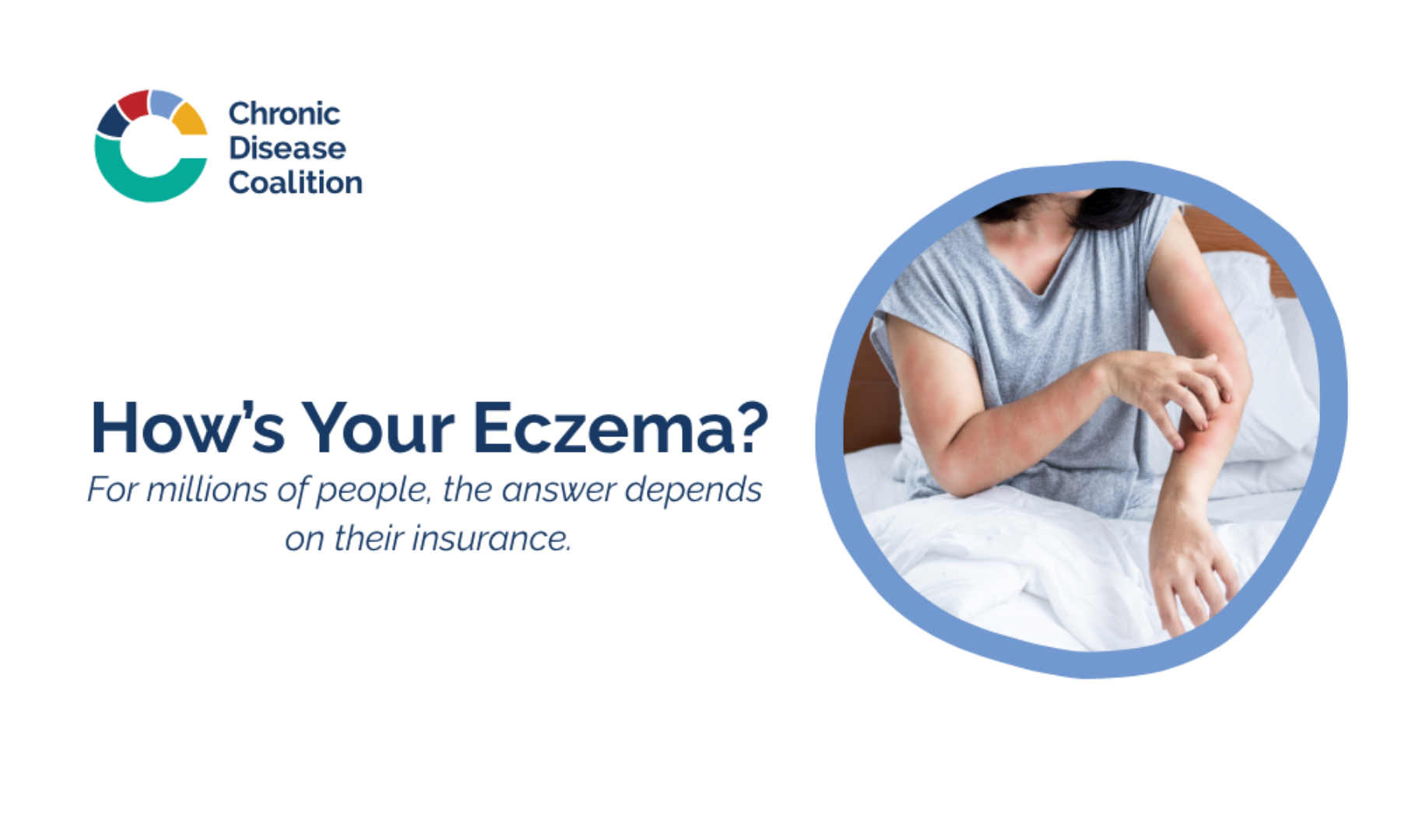How is Your Eczema?