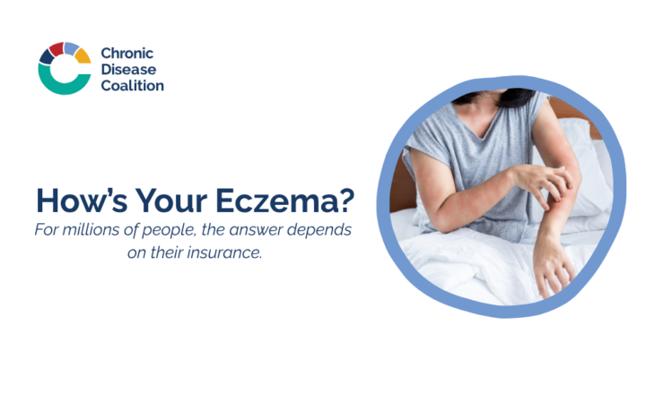 How is Your Eczema?